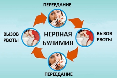 Лечение булимии в Фряново